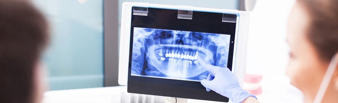 radiografía digital en Sants Montjuïc, Barcelona. Dentista en Sants Montjuïc, Barcelona. Clínica dental en Sants Montjuïc, Barcelona