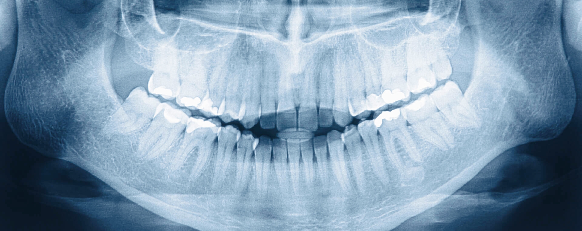 endodoncia en Sants Montjuïc, Barcelona. Dentista en Sants Montjuïc, Barcelona. Clínica dental en Sants Montjuïc, Barcelona