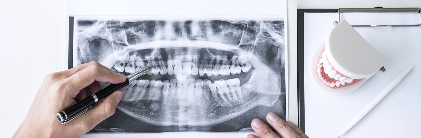 peritajes odontológicos en Sants Montjuïc, Barcelona. Dentista en Sants Montjuïc, Barcelona. Clínica dental en Sants Montjuïc, Barcelona. 