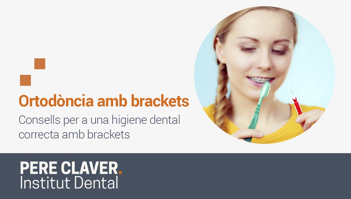 Ortodòncia amb brackets. Consells per a una higiene dental correcta amb brackets