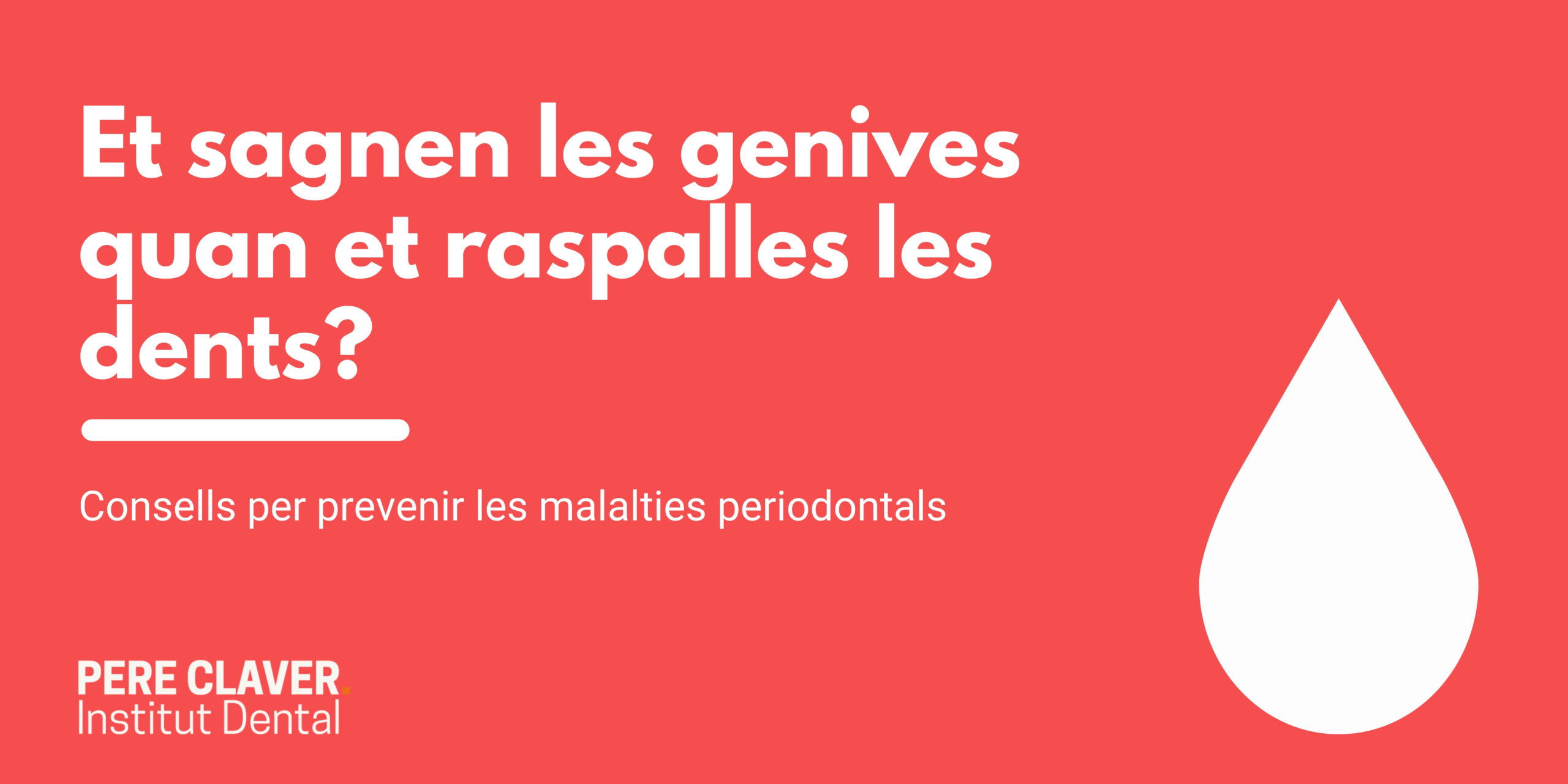 Et sagnen les genives quan et respalles les dents?