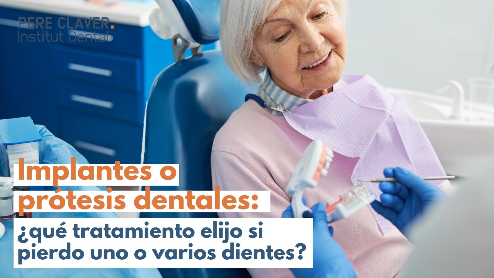 implantes prótesis dentales