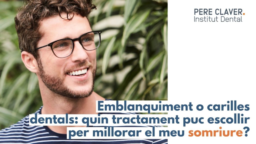 Blanquejament o carilles dentals: quin tractament trio per millorar el meu somriure?