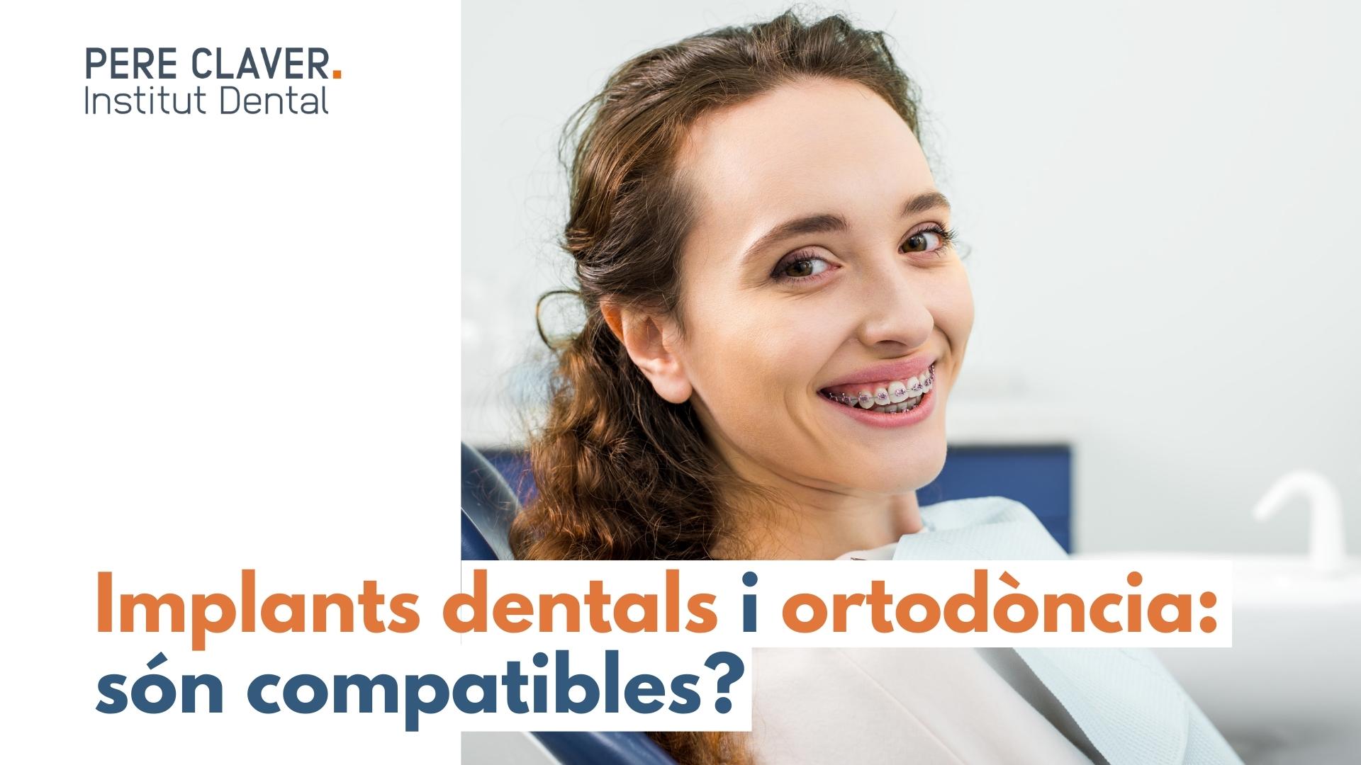 Implants dentals i ortodòncia: són compatibles?