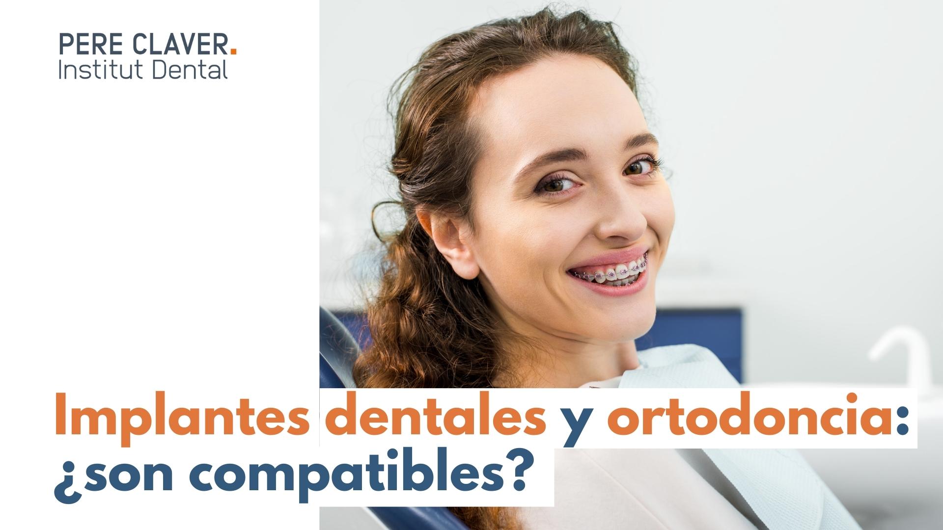 Implantes dentales y ortodoncia: ¿son compatibles?