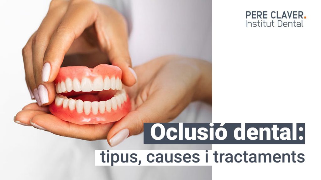 Oclusió dental: tipus, causes i tractaments