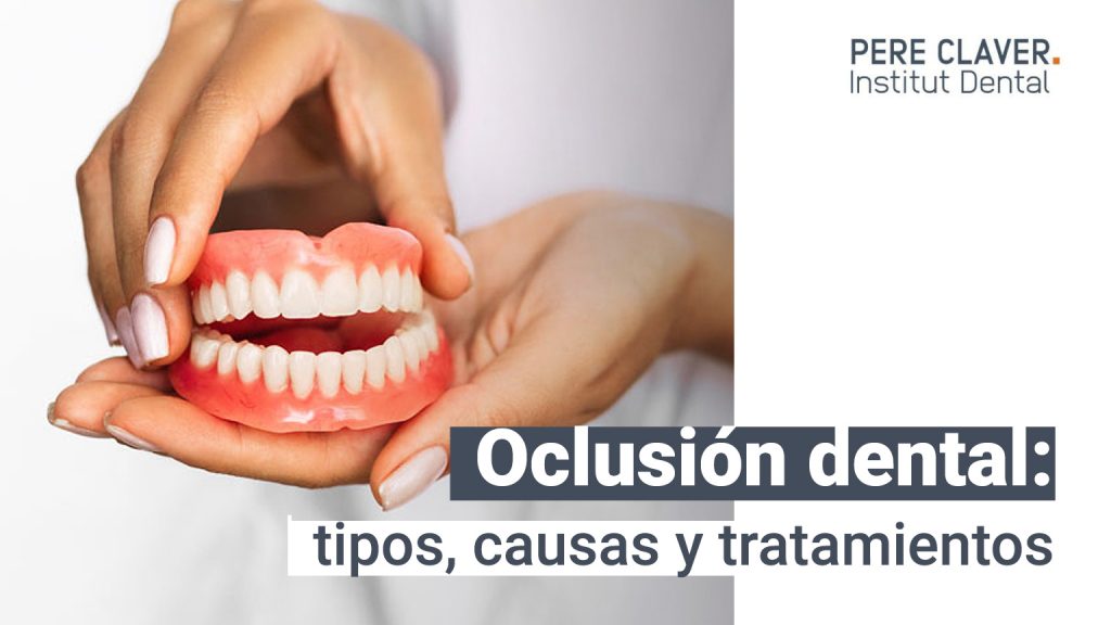 Oclusión dental: tipos, causas y tratamientos