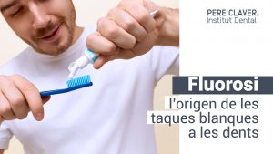 Fluorosi: l’origen de les taques blanques als dents